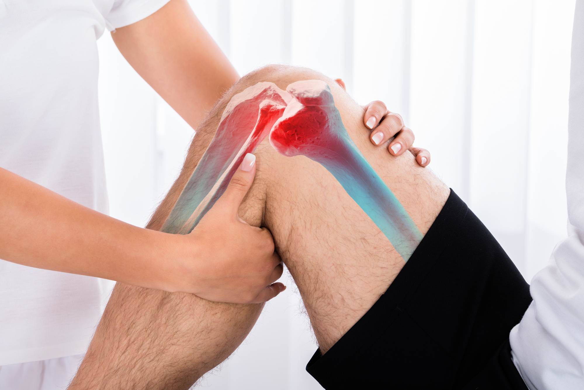 Rotura de Ligamento Cruzado Anterior